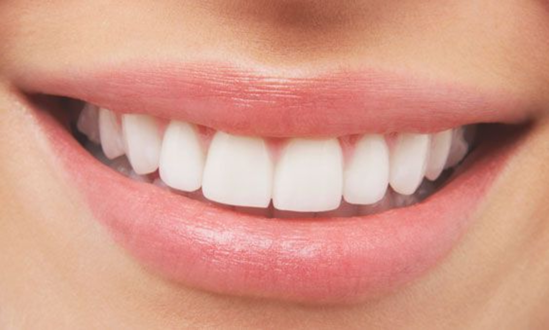 Creating a Smile